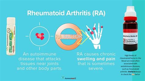 Natural Homeopathy Remedies for Rheumatoid Arthritis Relief – Homeomart