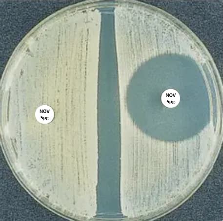 Image result for Staphylococcus Saprophyticus Infection