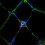 Clinical Center Published Research | Clinical Center