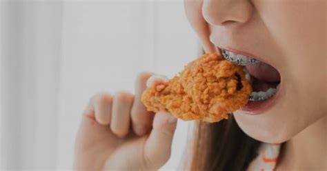 9 Chips You Can Eat With Braces Safely! Ultimate [year] Guide