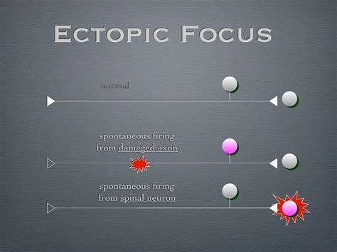 疼痛機制 The mechanism of Pain | PPT