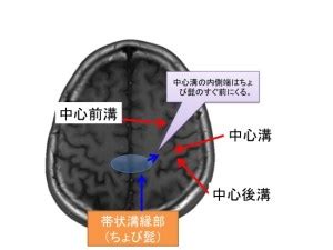 Image result for Pressure Monitor Module