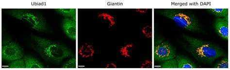 Significance of Ubiad1 for Epidermal Keratinocytes Involves More Than ...