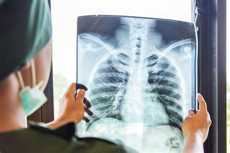 About - California Mobile X-Ray