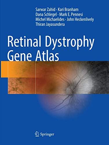 Buy Retinal Dystrophy Gene Atlas Book Online at Low Prices in India ...