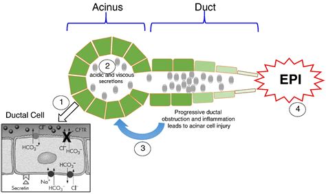 Pancreatitis and pancreatic cystosis in Cystic Fibrosis - Journal of ...