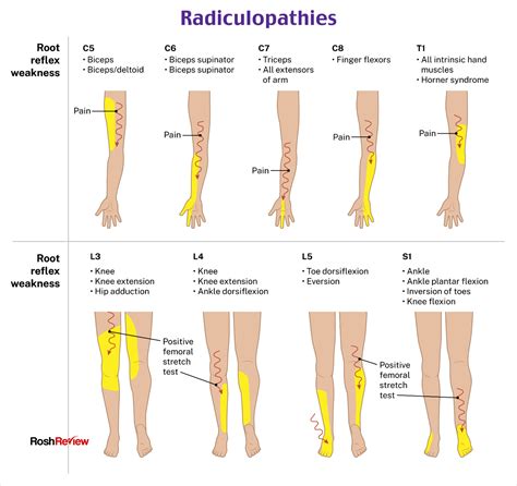 Lower Extremity Exam 的图像结果