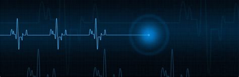 Image result for What Does Synchronized Cardioversion Do