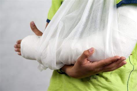 Curing Plaster Cast 的图像结果