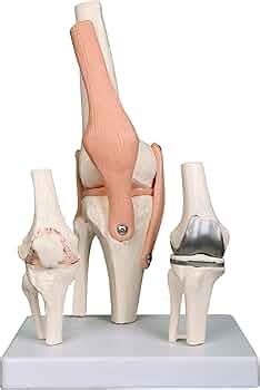 Kay Kay Industries Premium Knee Joint Model Anatomy Set | Life Size ...