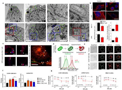 Dexamethasone-Induced Fatty Acid Oxidation and Autophagy/Mitophagy Are ...