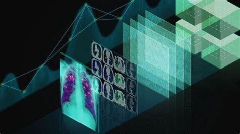 Medical Image Processing @ CVIT, IIIT Hyderabad