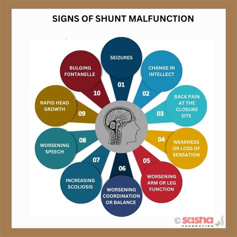 What is Hydrocephalus? How is it treated? Best Information
