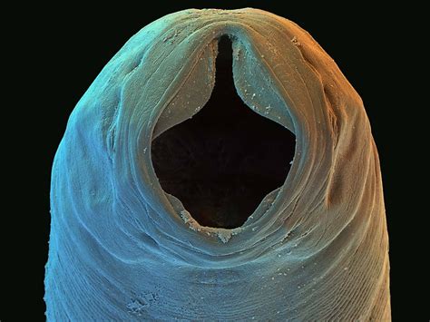 Necatoramericanus The World