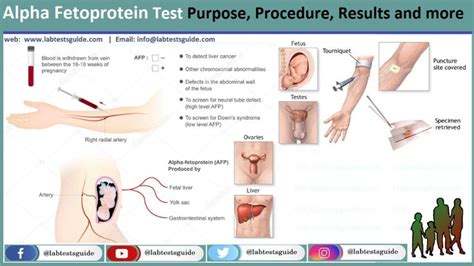 Image result for How AFP Test Done