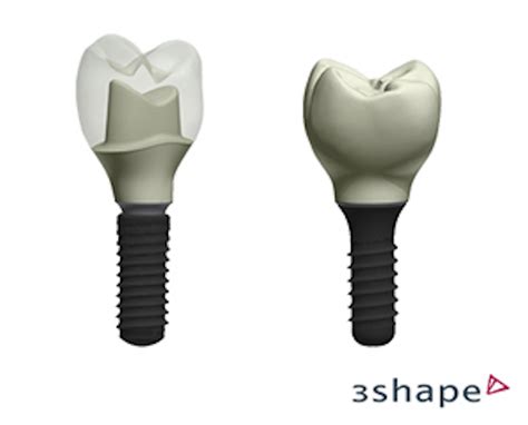 Straumann introduces a tapered implant for immediate placement and ...