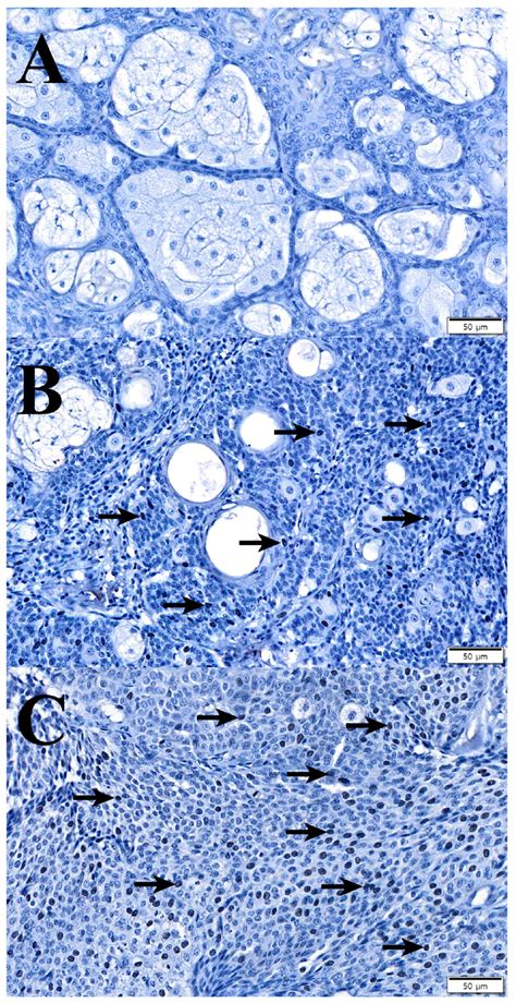 Histopathological and Immunohistochemical Characterization of Sebaceous ...