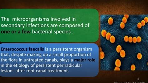 Image result for Enterococcus Faecalis Treatment Options