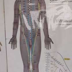 Best Acupuncture Doctors in Kanpur - Top Accpuncture Doctors near me ...