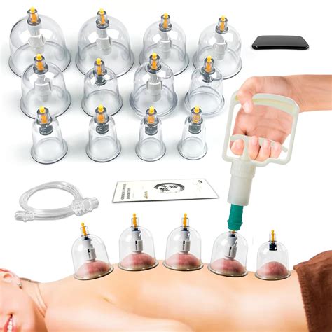 Chinese Cupping Therapy