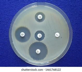Agar Disc Diffusion Method 的图像结果
