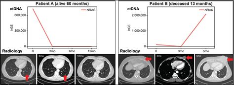 Blood-based biomarker may redefine the future treatment for advanced ...