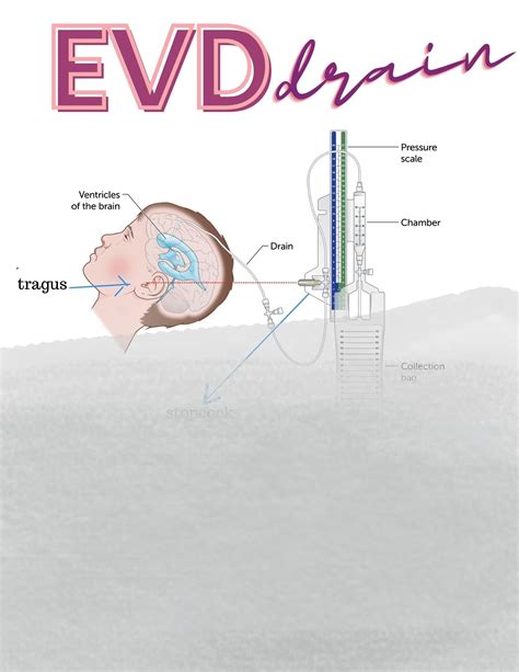 EVD Drain, Care For, Monitoring, and What Numbers Are Important, ICU Nurse Cheat Sheet, EVD - Etsy