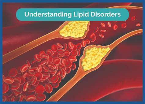 Understanding Lipid Disorders: Causes, Symptoms, and Treatments