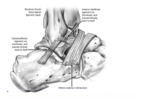 Hip Hop Dance Tutorial 的图像结果