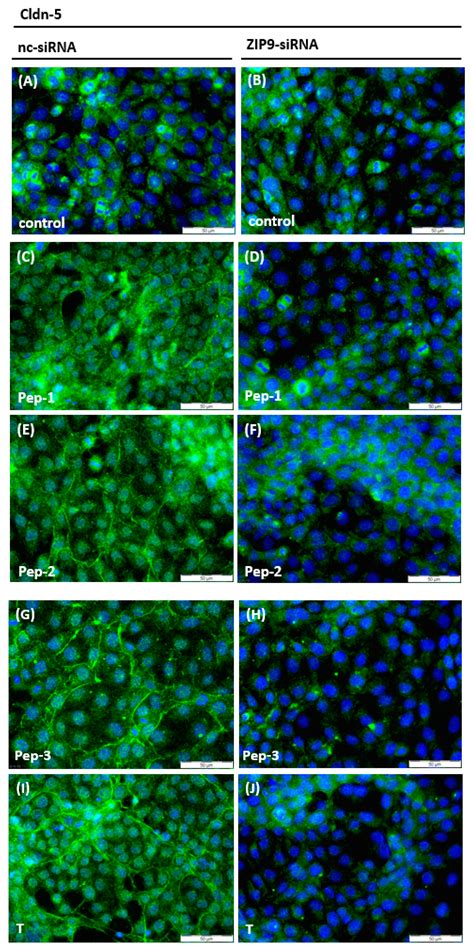 Tetrapeptides Modelled to the Androgen Binding Site of ZIP9 Stimulate ...