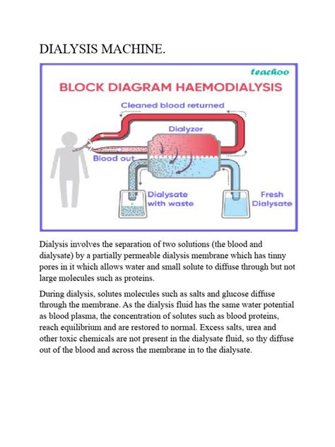 Image result for Dialysis Procedure Step by Step