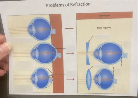 Image result for Refraction Physics 2 Hard Problems