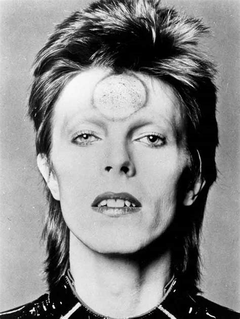 David Bowie Different Coloured Eye - themediocremama.com