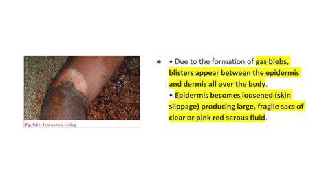 MSC IV_Forensic medicine - Thanatology.pdf