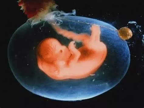 生命從什麽時候開始的？沒有成形的胚胎算生命嗎？【丁嘉麗老師采訪老法師】 - YouTube