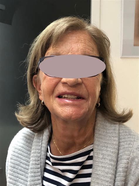 Beispielfotos Gesicht – Medical Beauty Trading GmbH