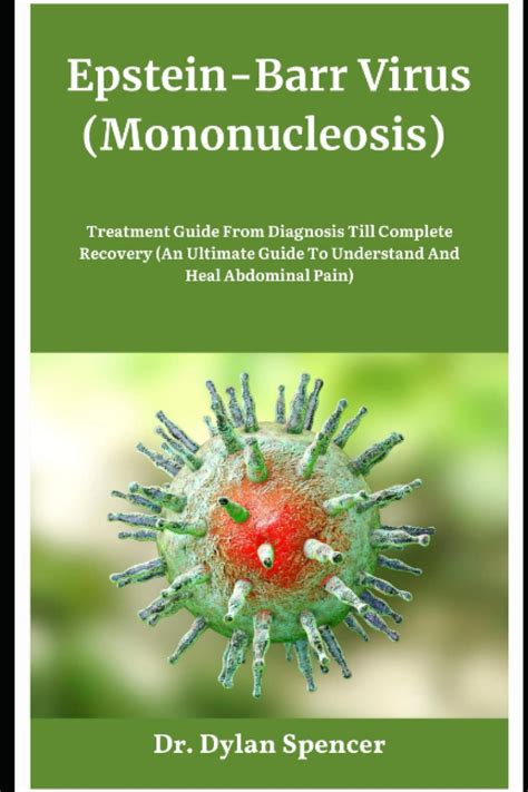 Buy Epstein-Barr Virus (Mononucleosis): Guide From Diagnosis Till ...