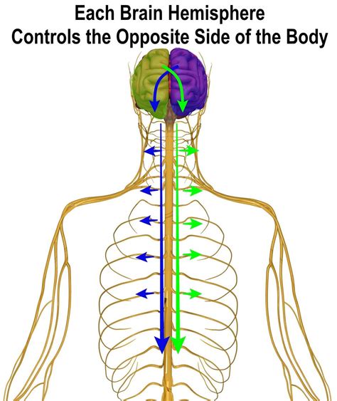 Hemiplegia Versus Hemiparesis - Rehab HQ