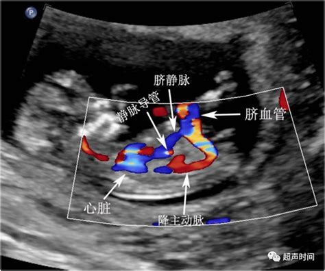 孕早期B超能告诉我们什么？ - 知乎