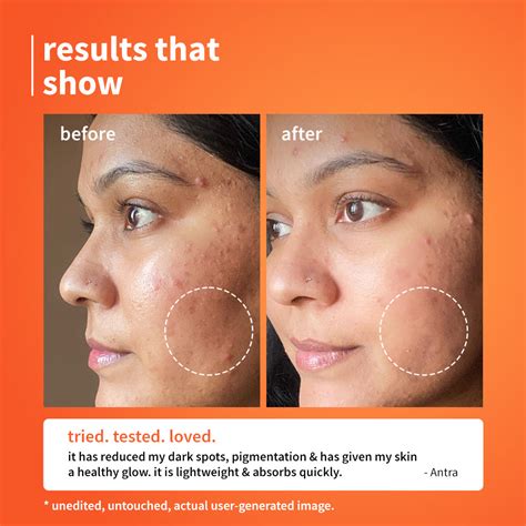 Calendula & 10% Vitamin C Barrier Boosting + Glow Serum – Plum