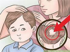 How To Prevent Hair Loss In Babies by How To Stop Hair Loss In Children With Pictures Wikihow How To Prevent Hair Loss In Babies