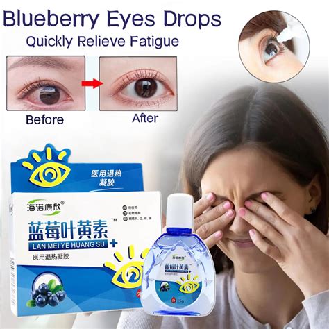 15ML Blueberry Eye Drops Itchy Relieves Dry Eyes Sore Red Eyes Discomfort Glaucoma Care Drops ...