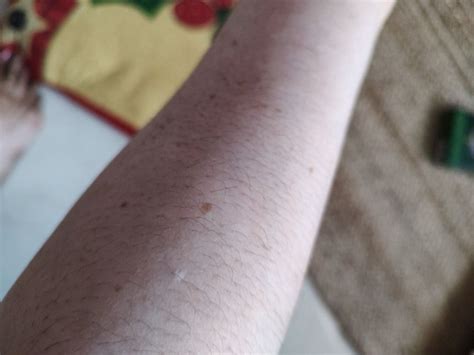 Fixderma Vitipause Gel Reviews Online | Nykaa