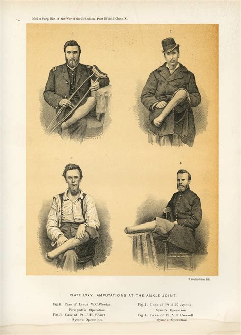 Civil War Hospital Amputations