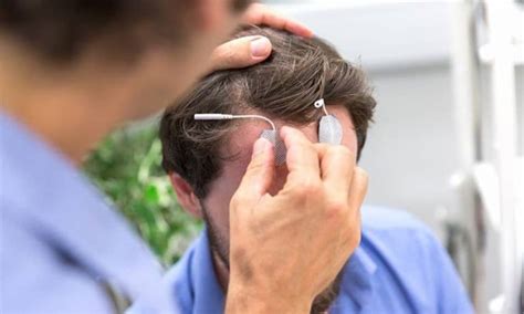 Image result for Non-Invasive Brain Stimulation