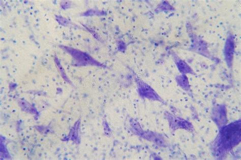 Image result for Brain Under Microscope