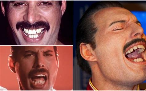 Queen's Vocalist Freddie Mercury Teeth Fix, Range, Singing and more.