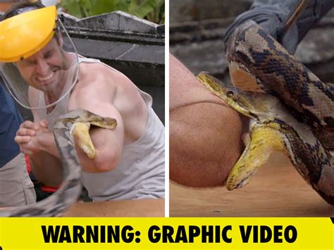 Image result for Retic Python Bite