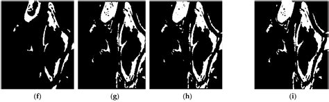 Hybrid Variability Aware Network (HVANet): A Self-Supervised Deep ...