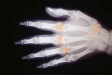 Image result for Hand Protection Safety Tips